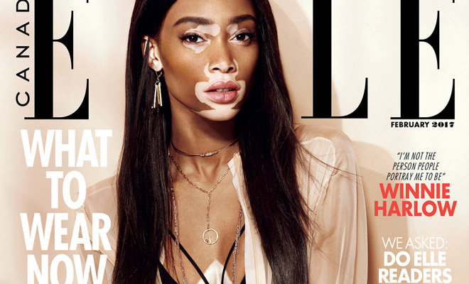 Winnie Harlow