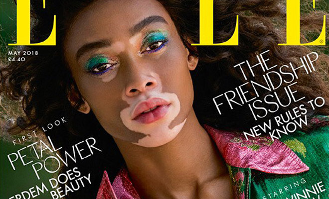 Winnie Harlow