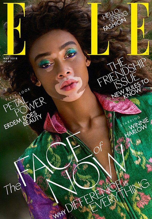 The May 2018 Magazine Thread Winnie-Harlow-Elle-UK-May-2018-01-620x894