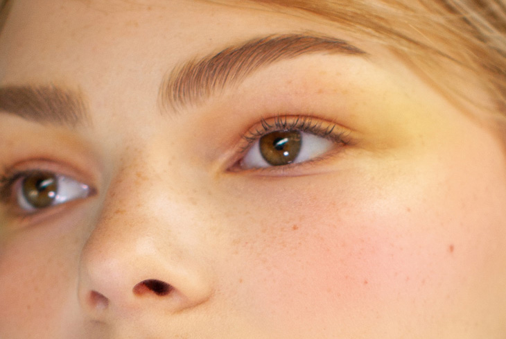 Home Remedies for Bags Under Eyes