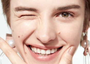 5 Tips for Reducing Acne or Breakouts